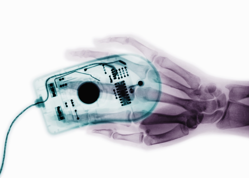 X-Ray Hand and Mouse