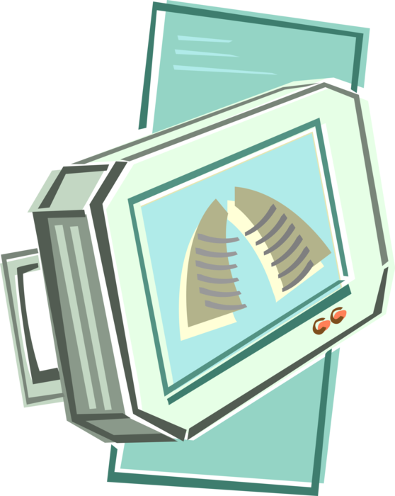 Vector Illustration of Health Care Hospital Chest X-Ray Scan on Monitor