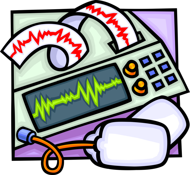 Vector Illustration of ECG Electrocardiogram Heart Rhythm Monitor Readout Graph