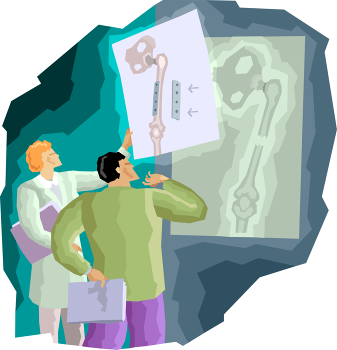 Vector Illustration of Health Care Professional Doctor Physicians Examine Broken Leg X-Ray with Bone Fracture Repair Metal Plate