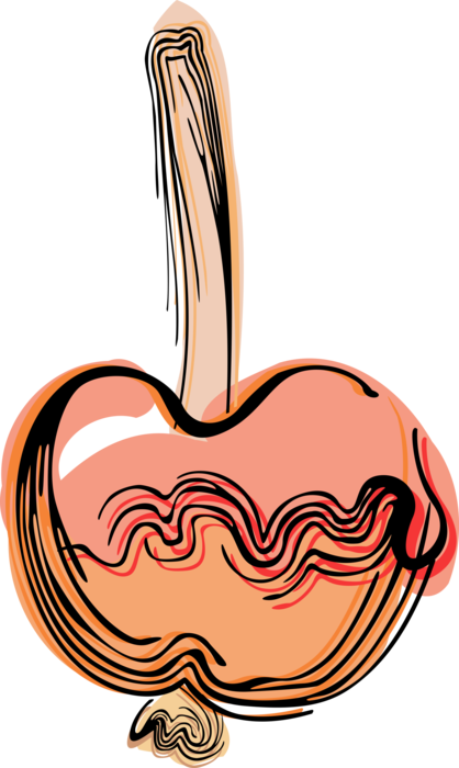 Vector Illustration of Candy Apple or Toffee Apple Covered in Sugar Candy Coating with Stick Handle