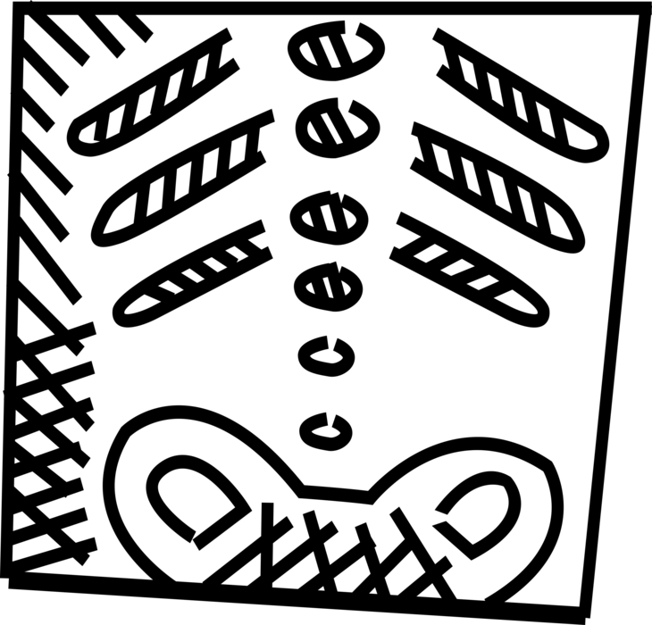 Vector Illustration of Medical Imaging Radiography X-Ray Electromagnetic Radiation Machine