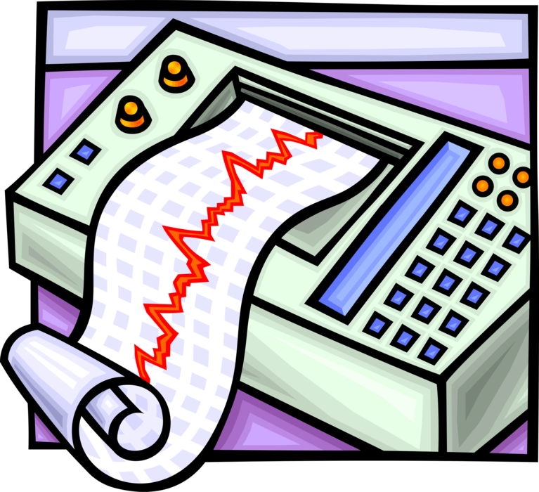 Vector Illustration of ECG Electrocardiogram Heart Rhythm Monitor Readout Graph