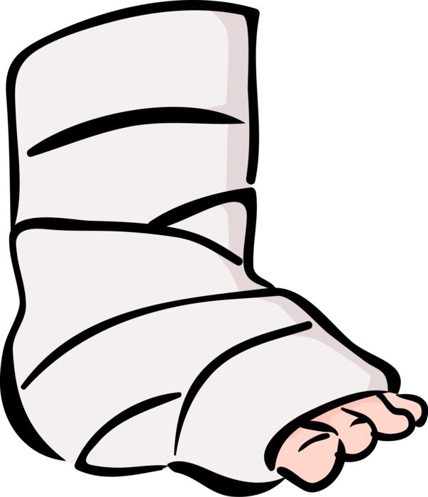 Vector Illustration of Accident Victim Patient with Broken Ankle
