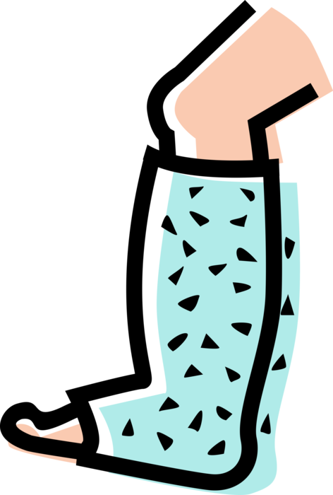 Vector Illustration of Accident Patient with Broken Leg in Plaster Cast