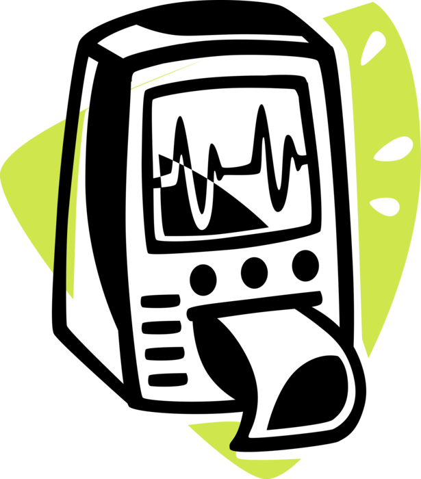 Vector Illustration of ECG Electrocardiogram Heart Rhythm Monitor Readout Graph