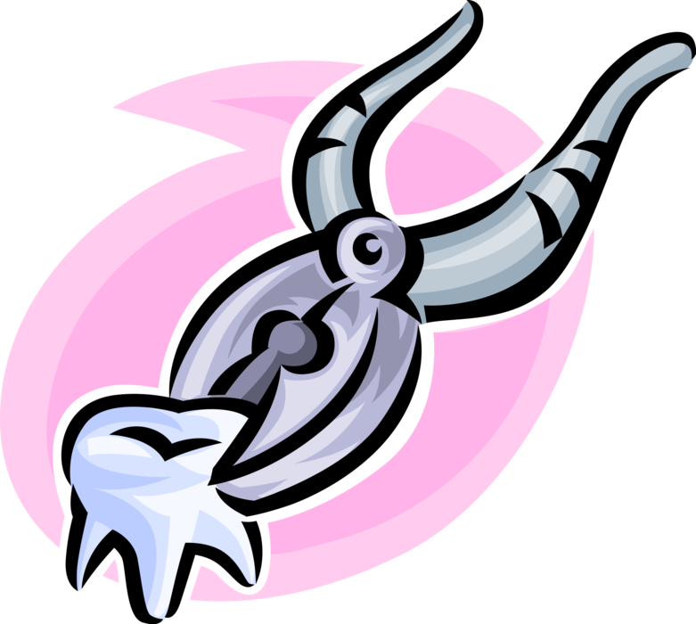 Vector Illustration of Molar Tooth Extraction with Dental Pliers Tool
